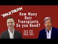 How Many Hair Transplants?- The Bald Truth - July 28th, 2023