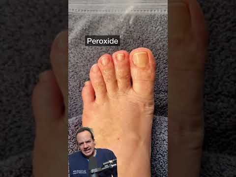 DOCTOR REACTS:HOME MADE CURE FOR FOOT FUNGUS! 😱 #shorts