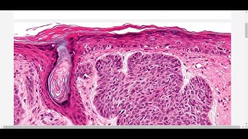 Histopathology Image Stain Separation and Normalization