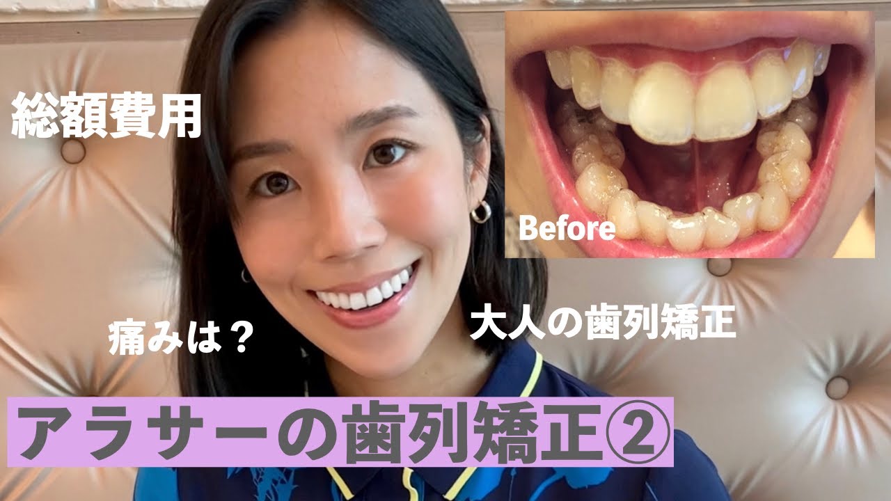 Orthodontics (Invisalign) is totally a game changer in my own life