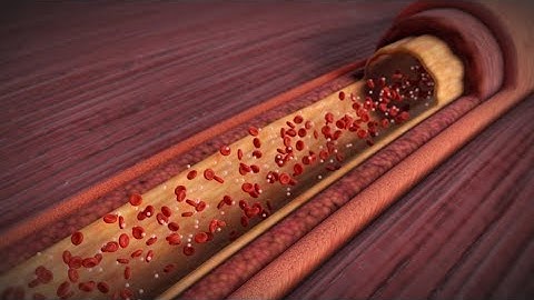 About Your Heart Attack | Nucleus Health