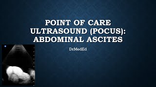 Point of care ultrasound (POCUS) : Abdominal Ascites