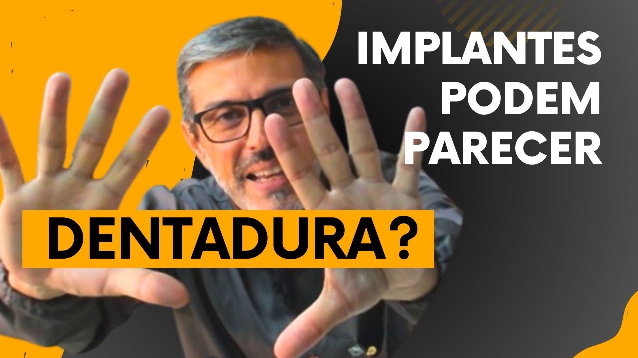 SEUS IMPLANTES PROTOCOLO PODEM PARECER UMA DENTADURA NO FINAL DAS CONTAS?