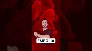 What is pulmonary embolism and cerebral embolism? #easyanatomy #anatomy #curiosities #tips