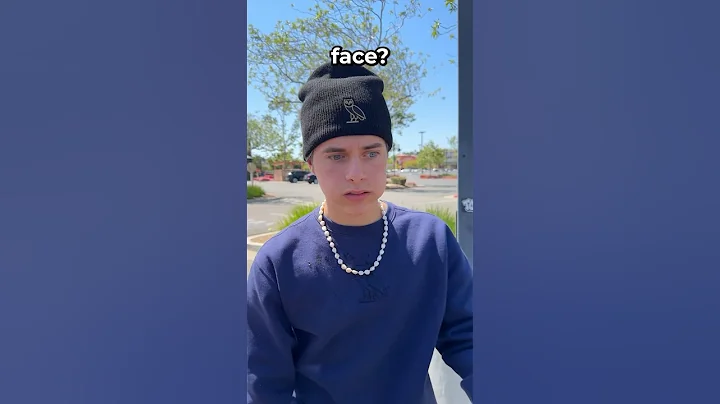 I HAVE THE WORLD'S RAREST ALLERGY! #shortsfeed #shorts