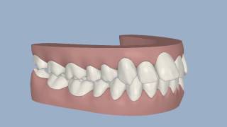 Invisible Orthodontics - Johnstone Diane2