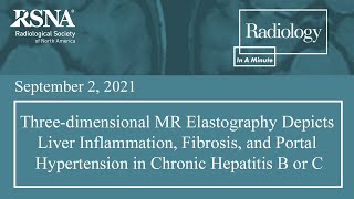 3D MR Elastography Detects Liver Inflammation Fibrosis Hypertension in Chronic Hepatitis B or C