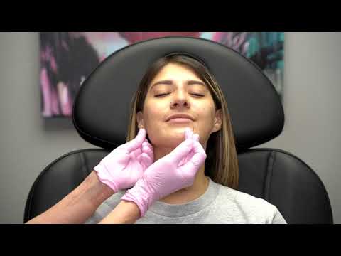 El Paso, TX | Jawline Filler Treatment | SkinSational MedSpa