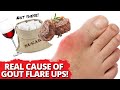 FINALLY Experience FOOD FREEDOM From Gout Attacks.. The REAL Cause Revealed!