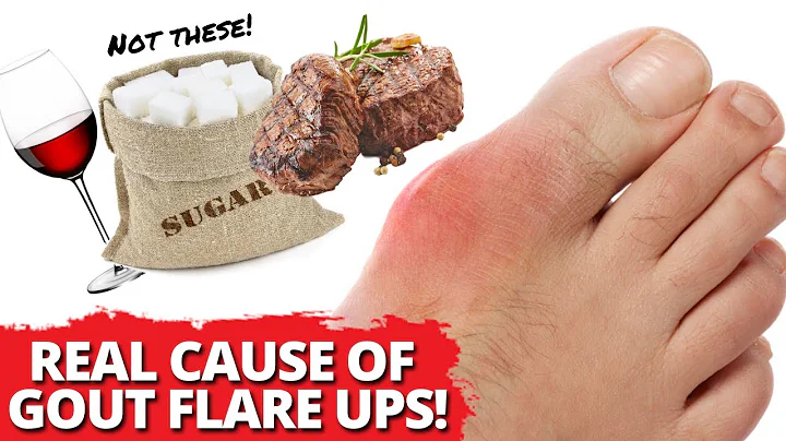 FINALLY Experience FOOD FREEDOM From Gout Attacks.. The REAL Cause Revealed! - DayDayNews