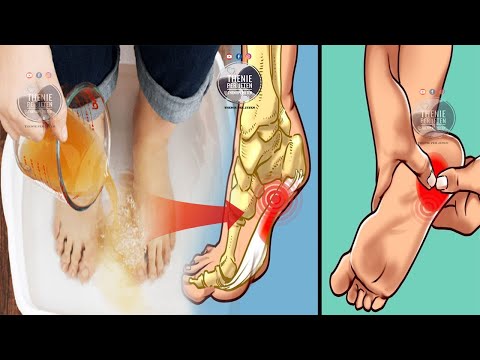 Video: A janë të dhimbshëm mbushësit e lëkurës?