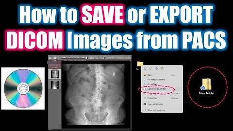 How to save DICOM images from PACS #howto #radiology #dicom