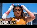 The 20-Year-Old With Butterfly Skin | BORN DIFFERENT