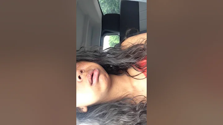 I GOT MY WISDOM TEETH OUT?!?!