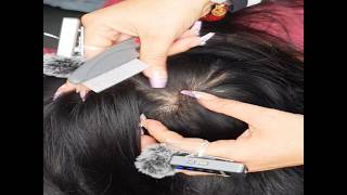 Long Hair Scalp Transformation | Most Satisfying Dandruff Cleaning Ever D0001