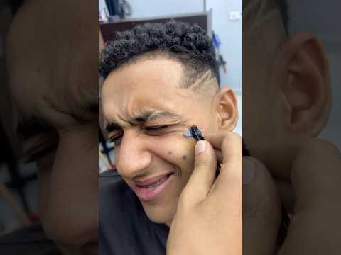 ازالة الحباية المتسلطنة من الخد Fyp Foryou Foryoupage Viral Explore Comedy Asmr 