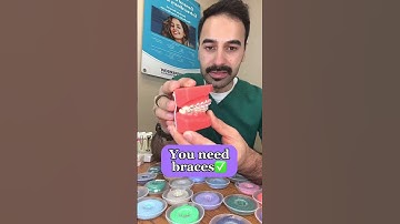 Thumbnail of Signs you need braces🚨 #shorts