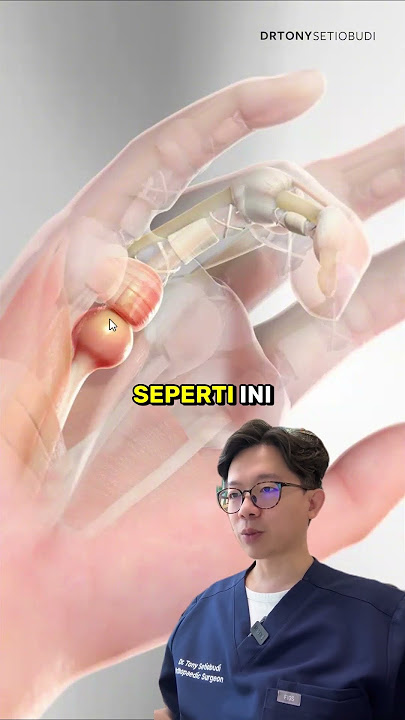 AWAS TRIGGER FINGGER! 🚨