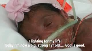 1lb 10oz Preemie to a one-year-old miracle babygirl