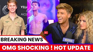OMG Shocking Update😱: American Girls Flood Robert Irwin&#39;s DMs After EPIC Shirt-Tease on DWTS!