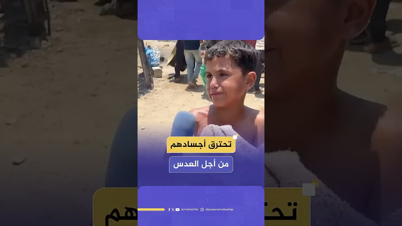 أطفال يصابون بجروح وحروق أثناء تدافعهم على تكية طعام تقدم وجبة العدس