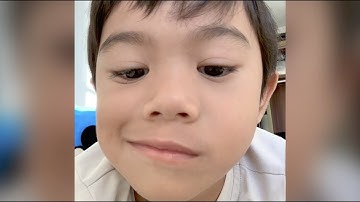 Sedric - iPhone iOS 10: Photos Memories