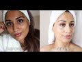 Skin Lightening In Just 1 Week - DIY All Natural Ingredients