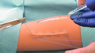 تعلم تخدير و خياطة الجروح التنجديه matress suture