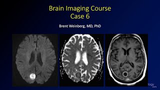 Neuroradiology board review 2 case