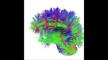 Human Brain connectome visualisation using DTI
