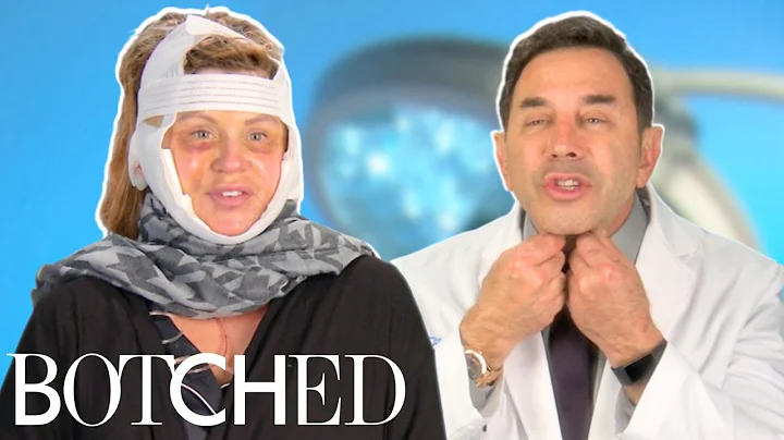 Dr. Nassif Fixes Lisa’s Facelift Gone Wrong FULL TRANSFORMATION | Botched | E!