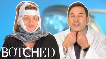 Dr. Nassif Fixes Lisa’s Facelift Gone Wrong FULL TRANSFORMATION | Botched | E!