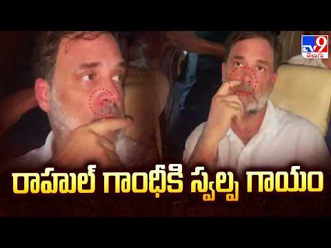 Rahul Gandhi Injured : రాహుల్ గాంధీకి స్వల్ప గాయం - TV9 - TV9