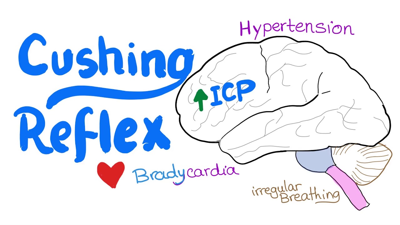 Hipertensión endocraneana puccini