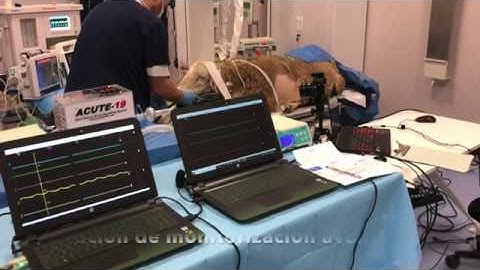 Making of Acute-19, desarrollo de un respirador de código abierto para pacientes con Covid19