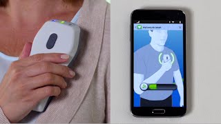 How to Set up and Use the MyCareLink Smart™ Patient Monitor –  including CRT-P