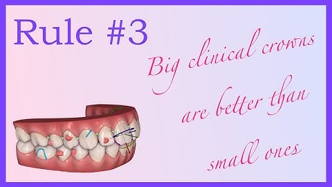 Big teeth, no problems! - Invisalign Mini Course 4 of 8
