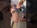 바늘이 전혀 없는 주사기