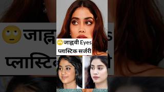 Jahnvi Kapoors Eyes Plastic Surgery