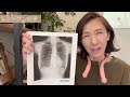 【精密検査】病院行ってきた‼️