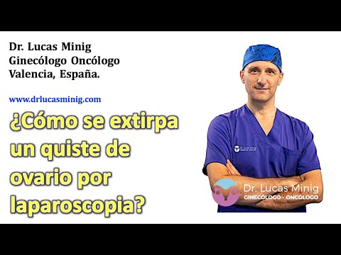 Vídeo: Quiste Ovárico Endometrioide: Síntomas, Tratamiento, Extirpación