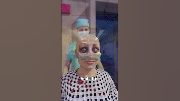 The Facelift That Left Her Eyes Stuck Open 😳