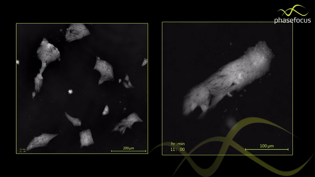 Label free imaging of Human Induced Pluripotent Stem Cells (iPSCs) by ...