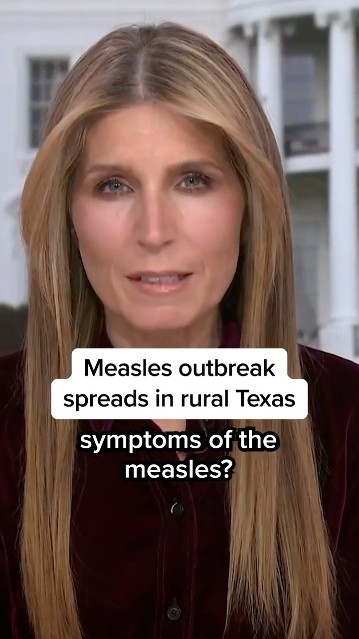 Measles outbreak spreads in rural Texas