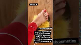 Turkish Celebrity Feet Sweet Feet Play Ebru Polat 