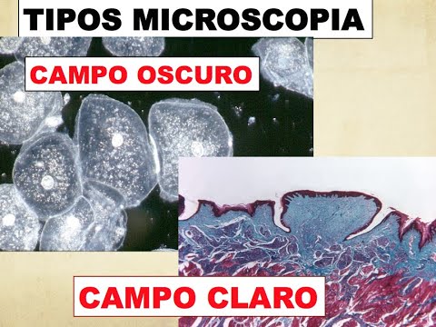 Video: ¿Qué prueba la microscopía de campo oscuro?