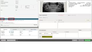 OrthoTrac: What's New Video v14.0