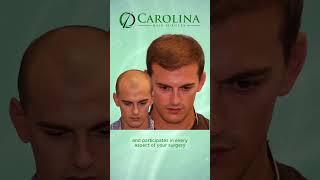 Life Changing Hair restoration by Dr. Vories - Carolina Hair Surgery