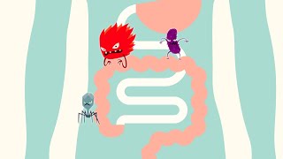 How to Treat Small Intestine Bacterial Overgrowth (SIBO) | Dr. Drew Sinatra