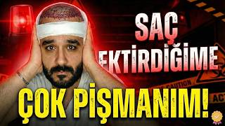 Saç Ekti̇rdi̇ği̇me Çok Pi̇şmanim Sakın İzlemeden Yaptırmayın